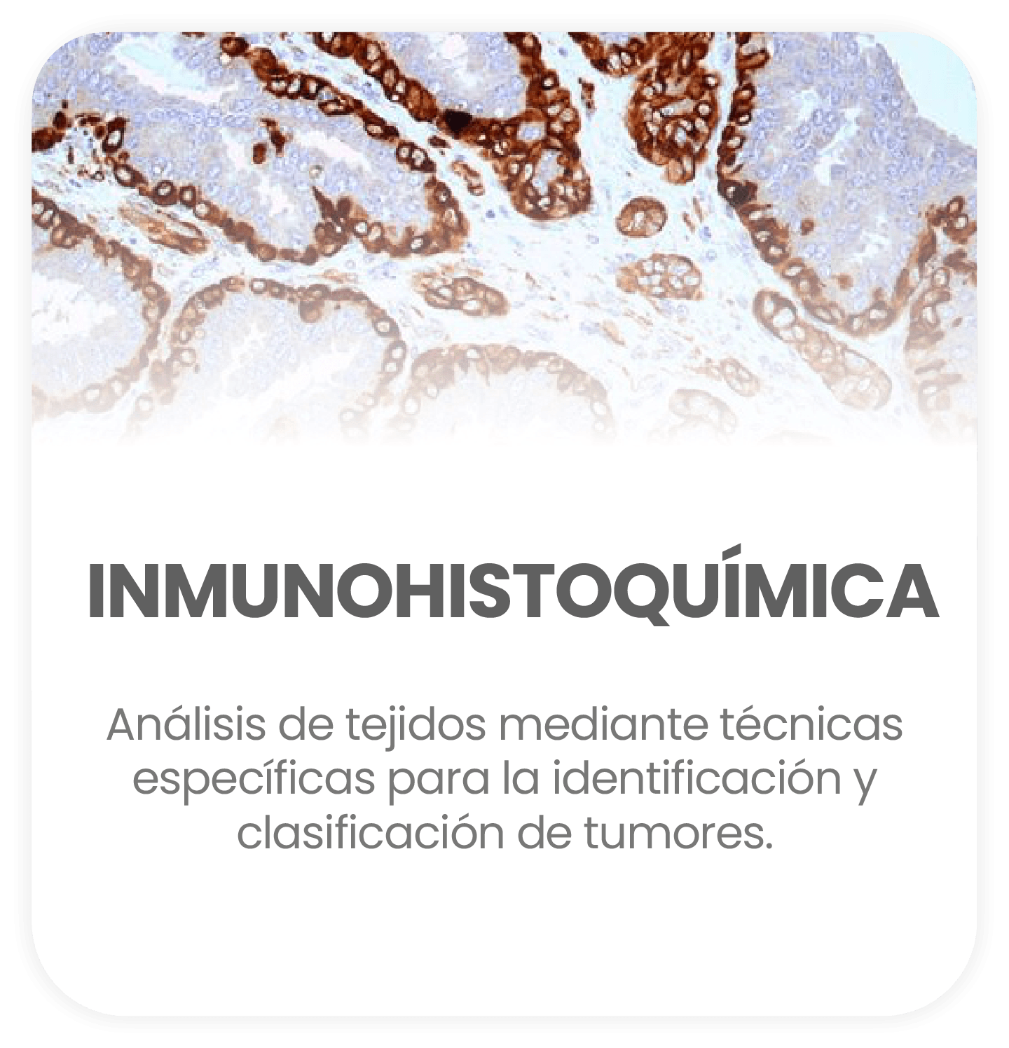 Inmunohistoquímica
